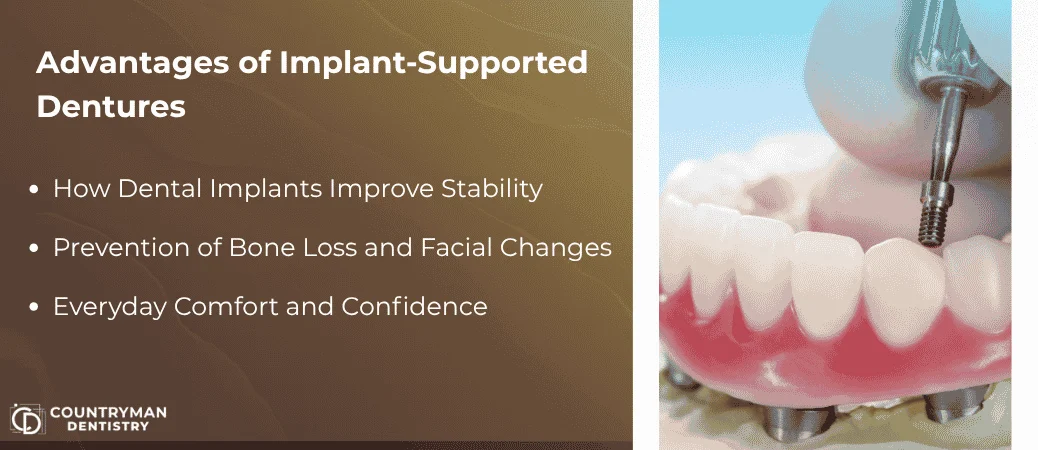 Benefits Of Implant-Supported Denture Solutions