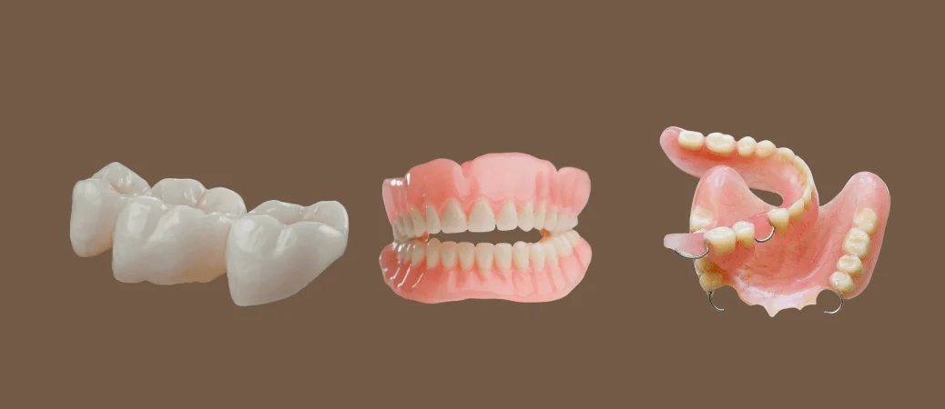 Comparing Bridges, Partials, And Dentures