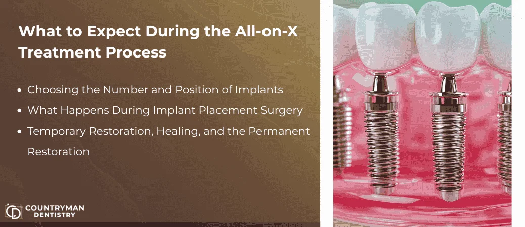 How All-On-X Treatment Works From Planning To Final Teeth