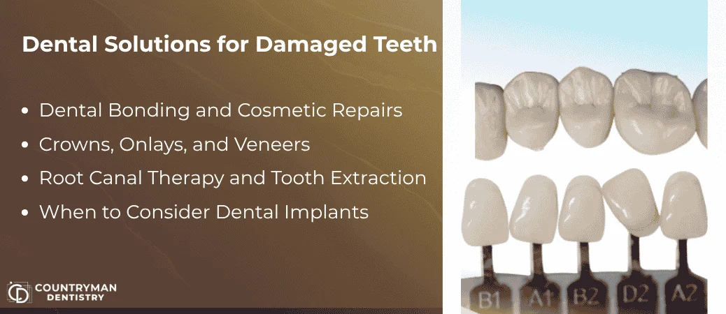 Treatment Options For Chipped, Cracked, Or Broken Teeth