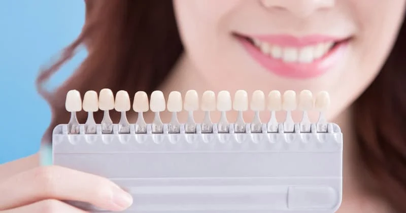 At-Home Tooth Whitening—Is It Safe?