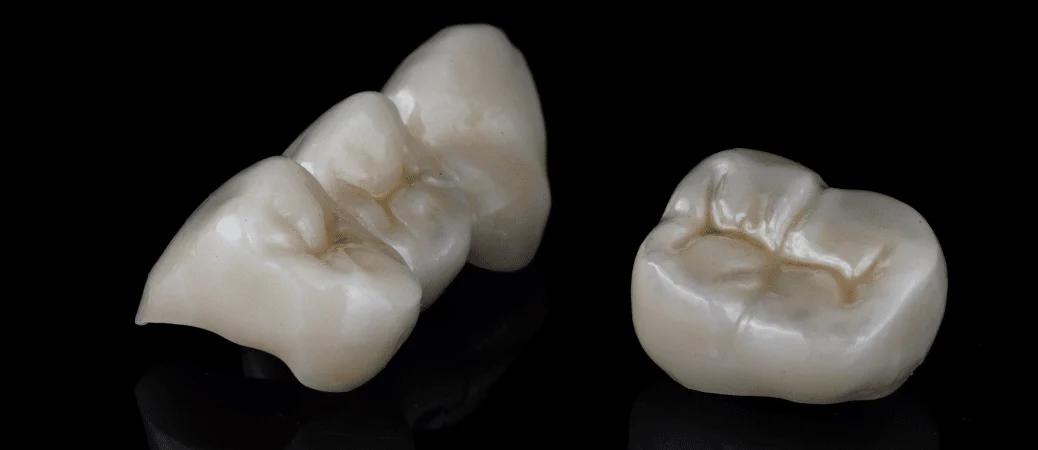 Broken Crown Or Filling? Here’s What To Do Before Seeing A Dentist