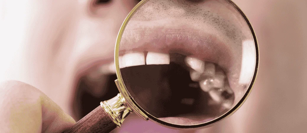 What Happens If You Ignore A Missing Tooth: Long-Term Risks Explained