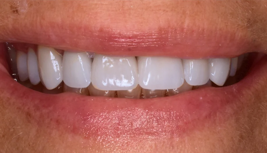 Smile Gallery 02 After