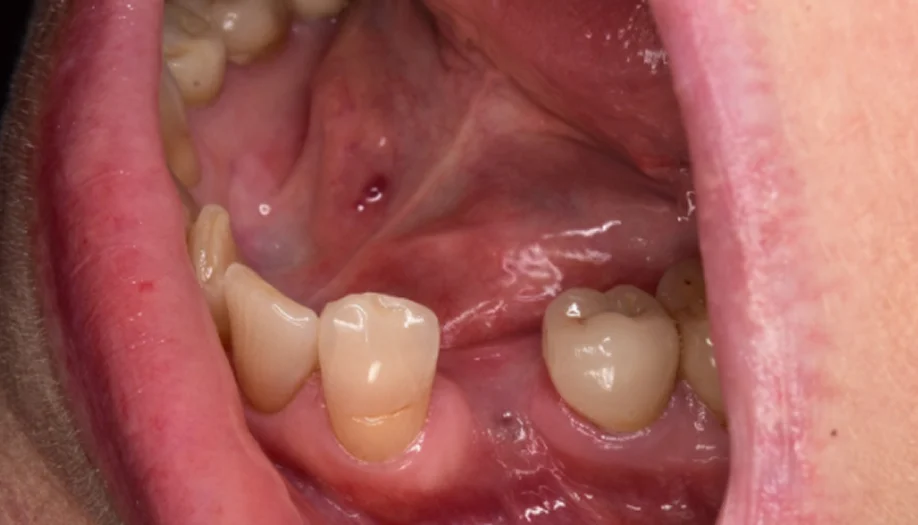 Smile Gallery 03 Before