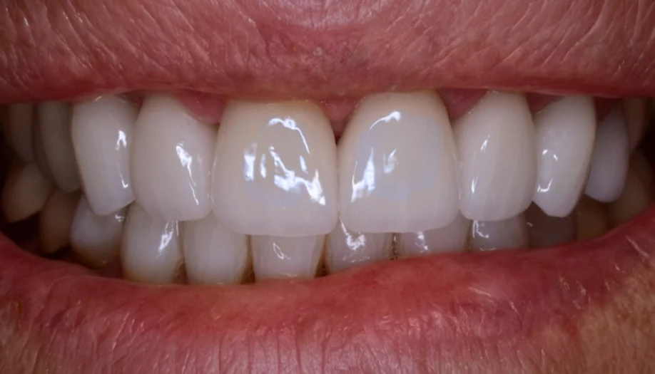 Smile Gallery 05 After