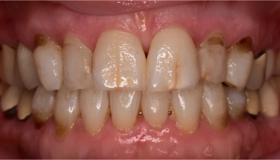 Smile Gallery 05 Before