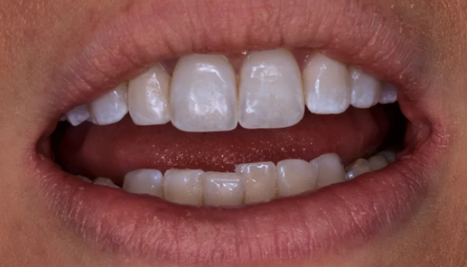 Smile Gallery 06 After