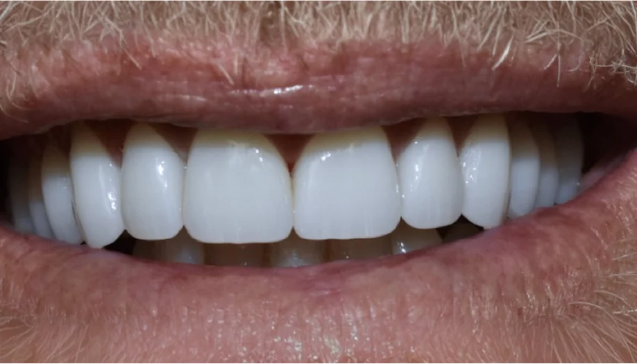 Smile Gallery 07 After