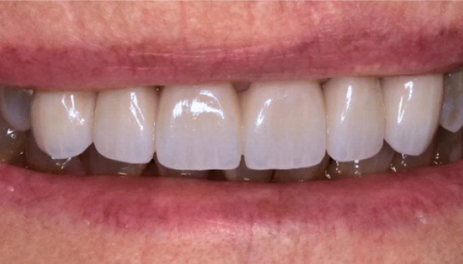 Smile Gallery 08 After