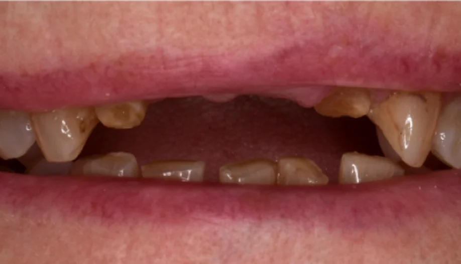 Smile Gallery 08 Before