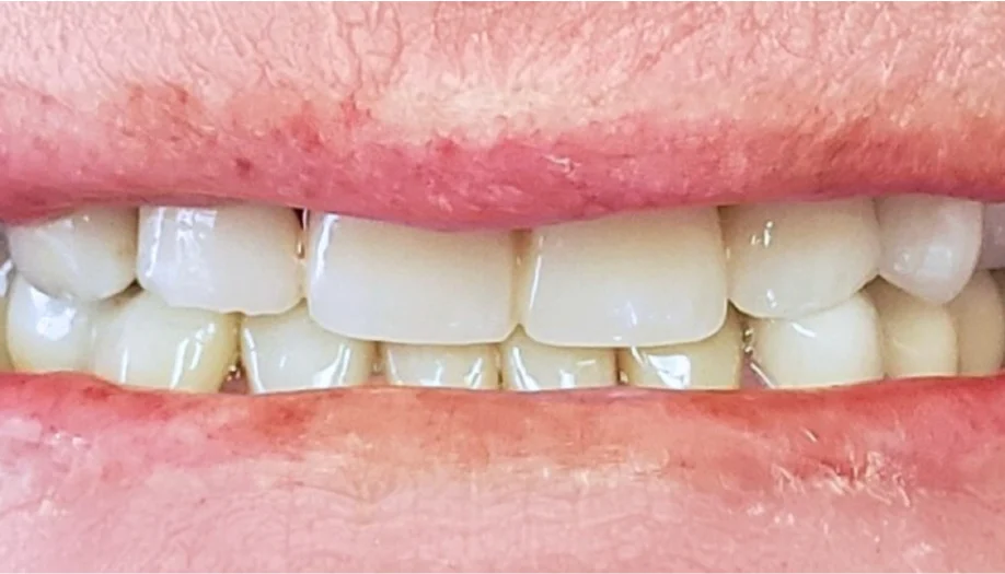 Smile Gallery 10 After