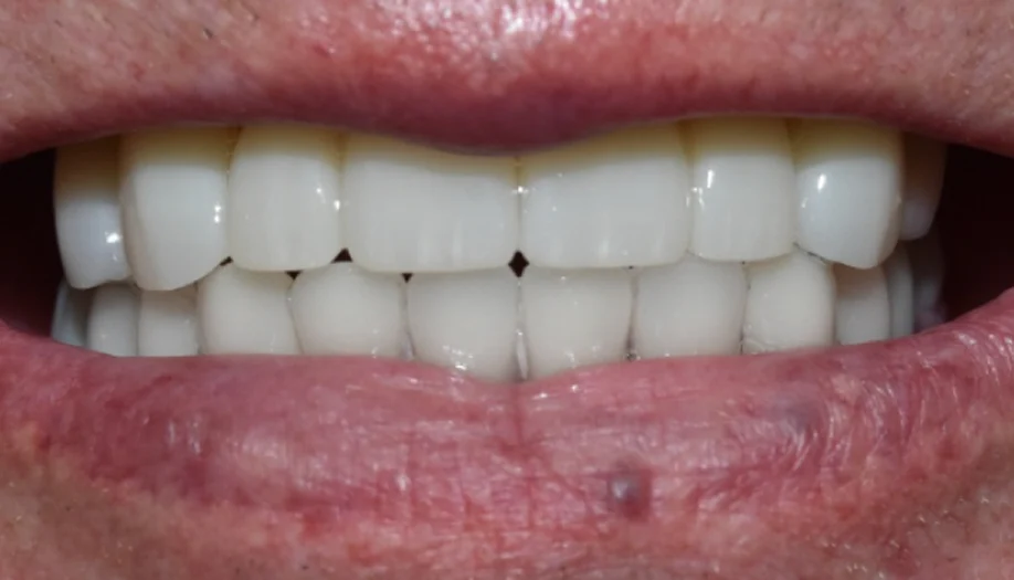 Smile Gallery 13 After