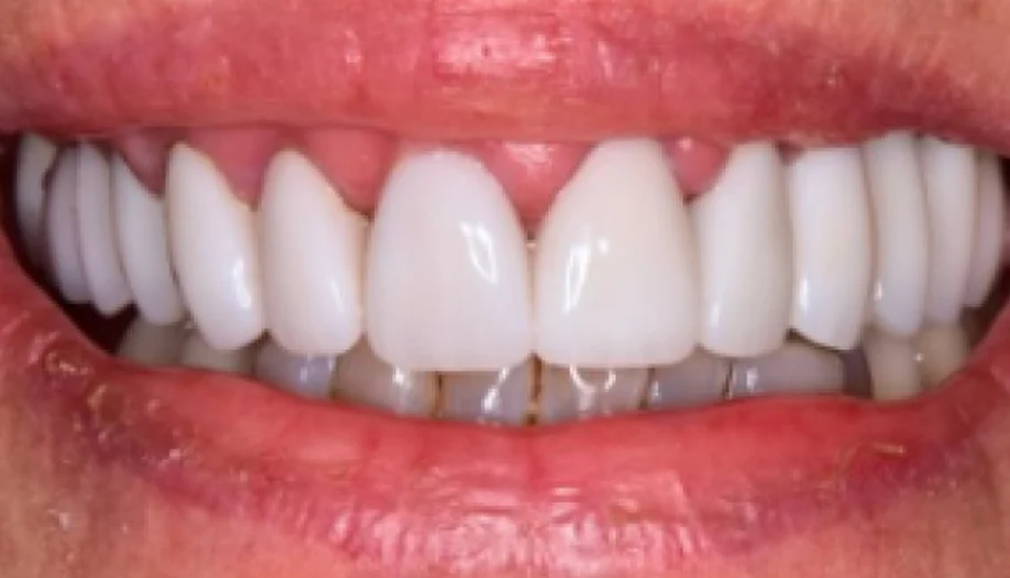 Smile Gallery 18 After