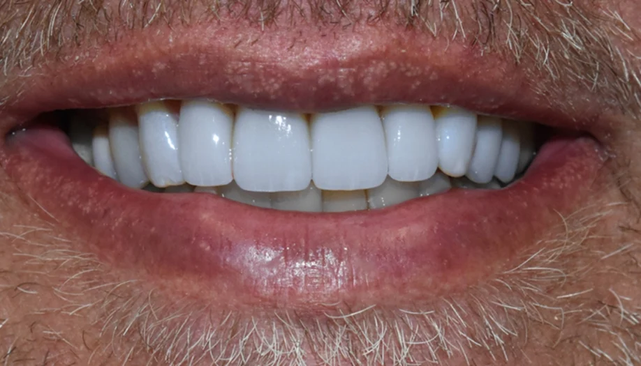 Smile Gallery 19 After