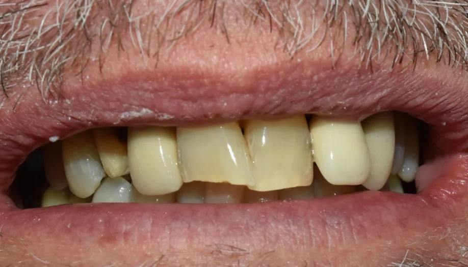 Smile Gallery 21 Before