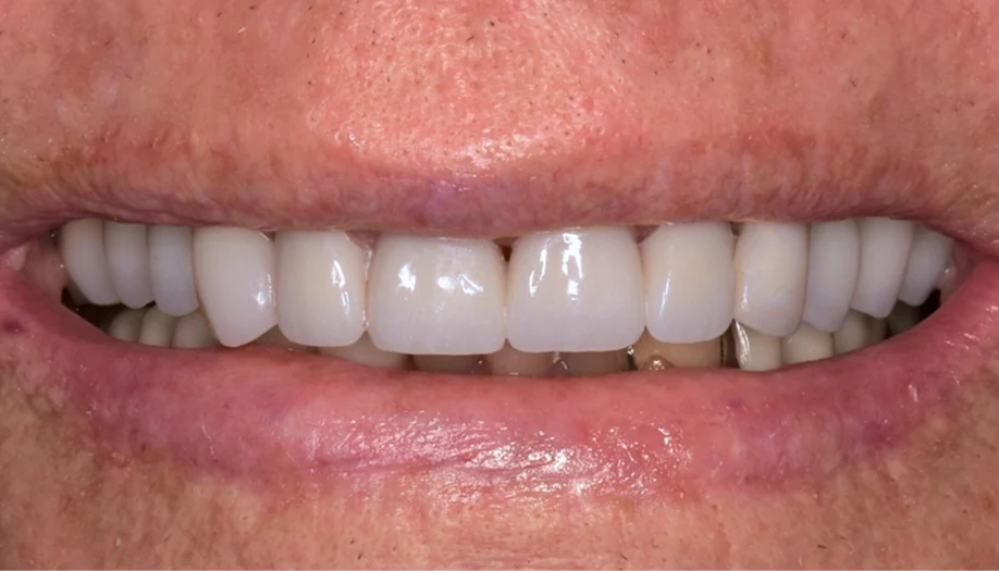 Smile Gallery 22 After