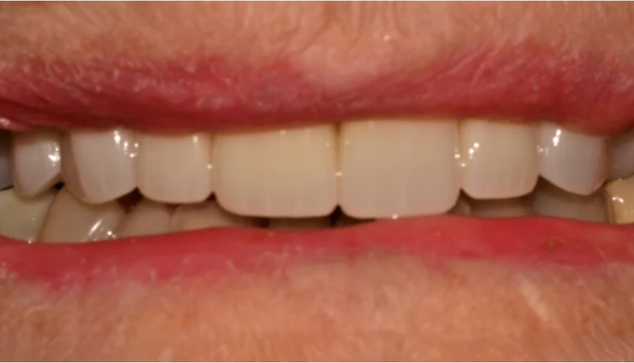 Smile Gallery 26 After