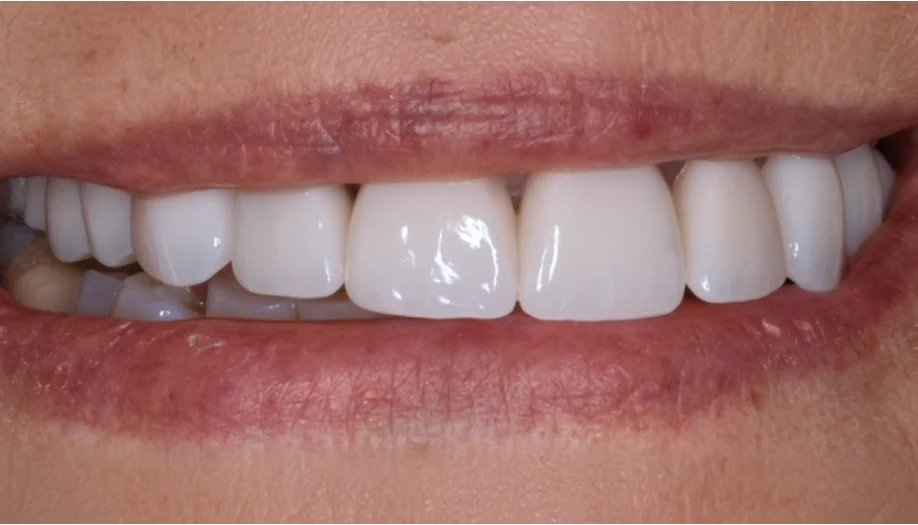 Smile Gallery 27 After