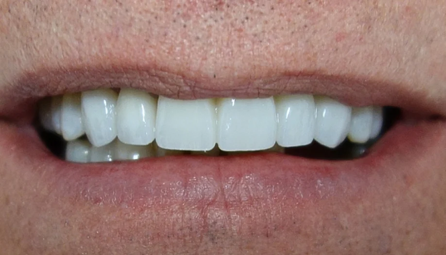 Smile Gallery 34 After