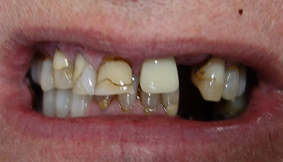 Smile Gallery 34 Before
