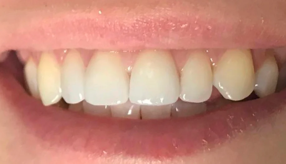 Smile Gallery 36 After