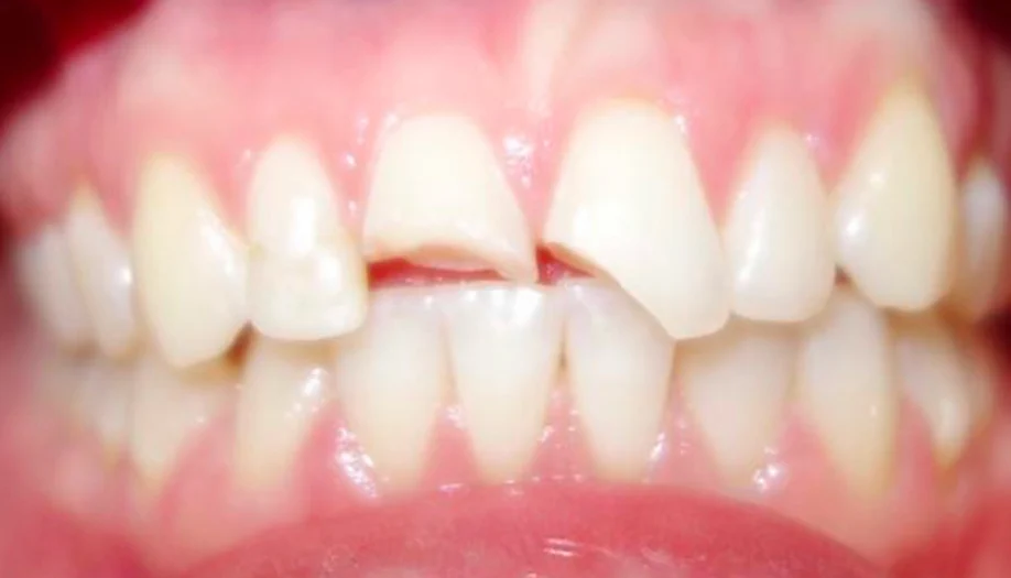 Smile Gallery 36 Before