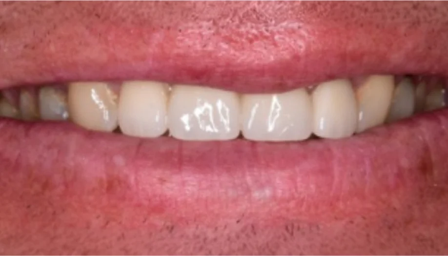 Smile Gallery 38 After