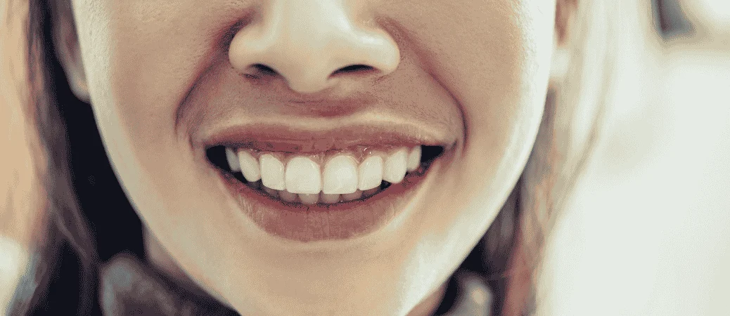 Short Teeth, Gummy Smile, Or Uneven Smile Line? How A Smile Makeover Is Actually Designed