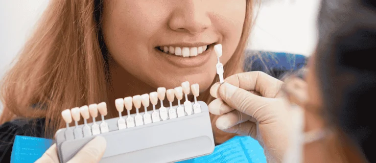 Veneers Vs Dental Bonding Comparison